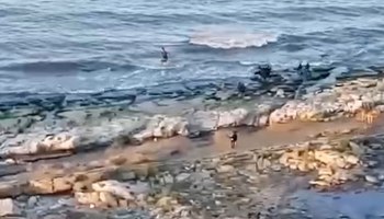 Стало известно о состоянии пострадавшего от собак в Махачкале ребенка